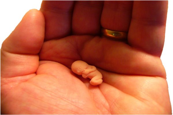 مجازات سقط جنین توسط مادر (1)